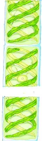 Spirogyra, a filamentous green alga